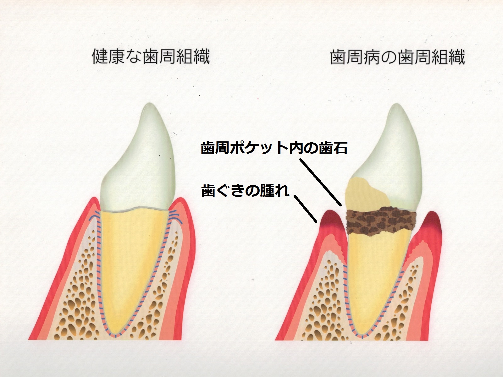 歯が全て抜けると６歳老けて見える | 世田谷区豪徳寺 西原デンタルクリニック